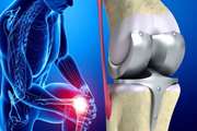 بیماران مبتلا به بیماری التهابی روده پس از تعویض مفصل ران و زانو با خطرات بیشتری روبرو هستند